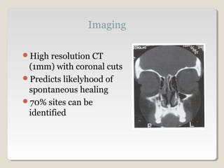 High resolution CT
(1mm) with coronal cuts
Predicts likelyhood of
spontaneous healing
70% sites can be
identified
 