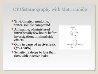 Tri-iodinated, nonionic,
water-soluble compound
Amipaque, administered
intrathecally few hours before
investigation, minimal side
effects
Only in case of active leak
(76-100%)
Sensitivity drops to less than
60% with inactive leaks
 