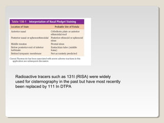 Radioactive tracers such as 131I (RISA) were widely
used for cisternography in the past but have most recently
been replaced by 111 In DTPA
 