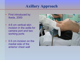 Endoscopic Parathyroid Surgery | PPT