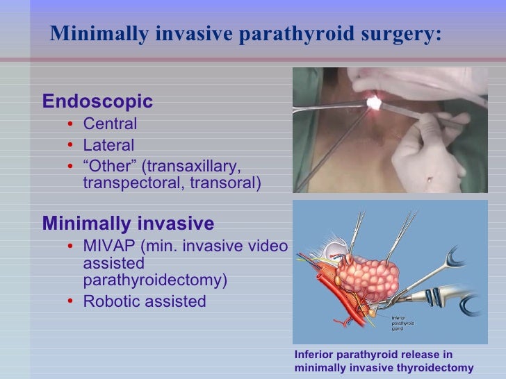 Endoscopic Parathyroid Surgery