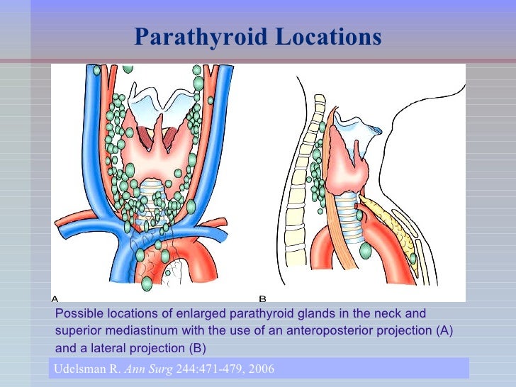 Endoscopic Parathyroid Surgery