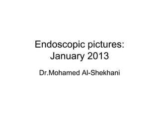 Endoscopic pictures:
   January 2013
Dr.Mohamed Al-Shekhani
 
