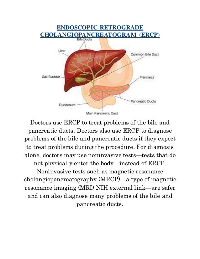 Endoscopic retrograde cholangiopancreatogram (ercp)
