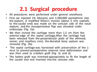 Endoscopic single handed septoplasty with batten graft for caudal | PPTX