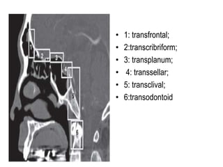 • 1: transfrontal;
• 2:transcribriform;
• 3: transplanum;
• 4: transsellar;
• 5: transclival;
• 6:transodontoid
 