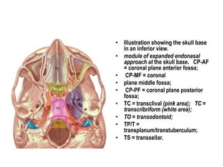 • Illustration showing the skull base
in an inferior view.
• module of expanded endonasal
approach at the skull base. CP-AF
= coronal plane anterior fossa;
• CP-MF = coronal
• plane middle fossa;
• CP-PF = coronal plane posterior
fossa;
• TC = transclival (pink area); TC =
transcribriform (white area);
• TO = transodontoid;
• TP/T =
transplanum/transtuberculum;
• TS = transsellar.
 