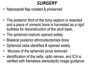 SURGERY
• Nasoseptal flap created & preserved
• The posterior third of the bony septum is resected
and a piece of vomeric bone is harvested as a rigid
buttress for reconstruction of the skull base.
• The sphenoid rostrum opened widely
• Bilateral posterior ethmoidectomies done
• Sphenoid ostia identified & opened widely
• Mucosa of the sphenoid sinus removed
• identification of the sella, optic nerves, and ICA is
verified with frameless stereotactic image guidance
 