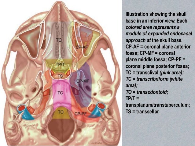 endoscopic skull base surgery level iii