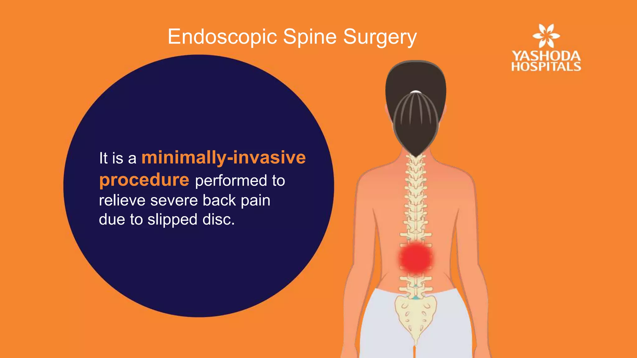 Endoscopic spine surgery | PPTX