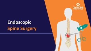 Endoscopic
Spine Surgery
 