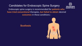 Candidates for Endoscopic Spine Surgery
Endoscopic spine surgery is recommended for patients who
have tried conventional therapies, but failed to obtain desired
outcomes in these conditions :
Scoliosis
 