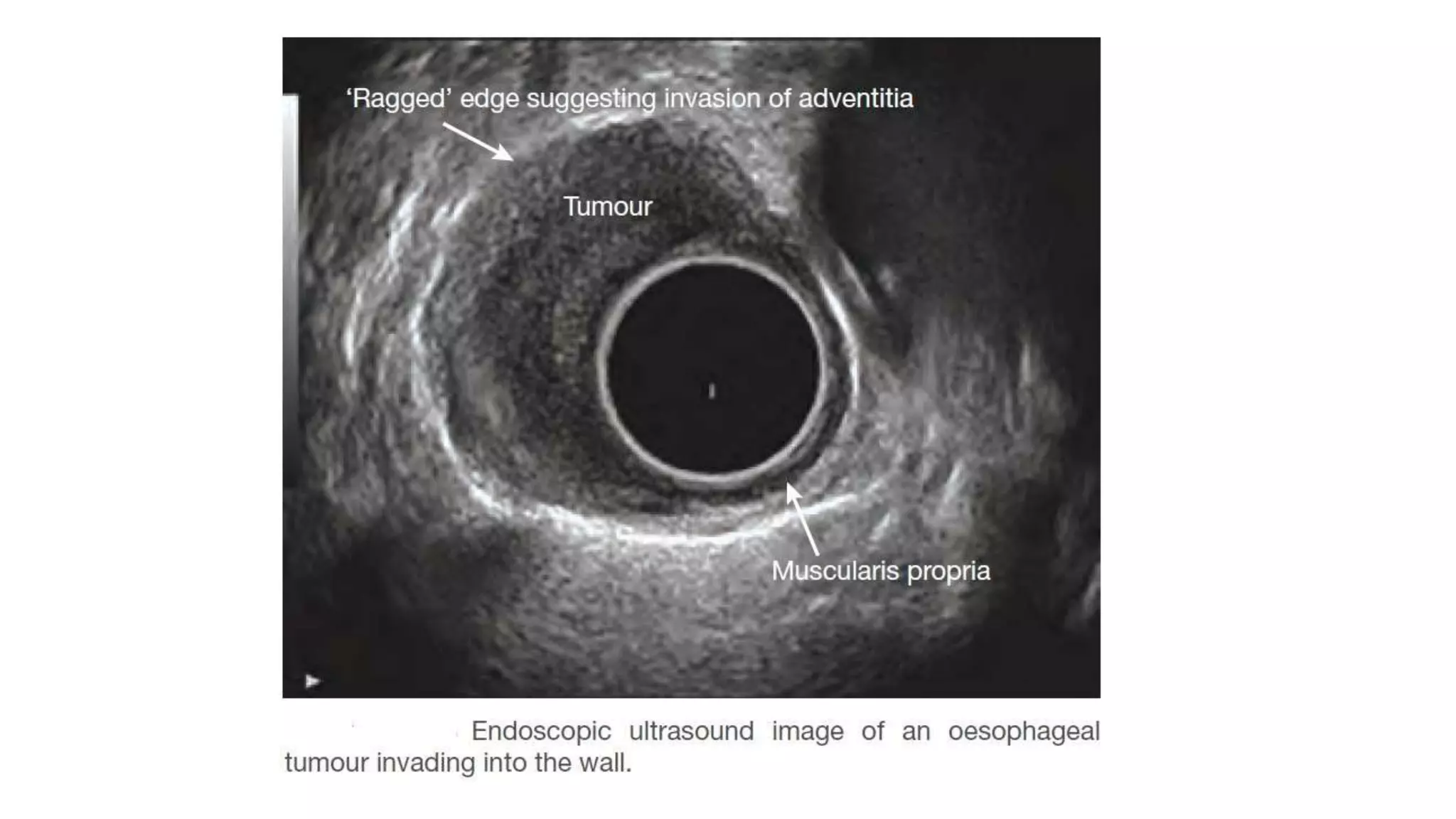 Endoscopic Techniques & Imaging Technologies in Surgical Diseases-Basic ...