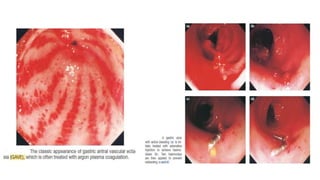 Endoscopic Techniques & Imaging Technologies in Surgical Diseases-Basic ...