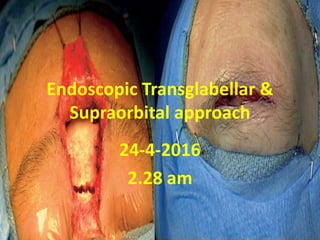 Endoscopic Transglabellar &
Supraorbital approach
25-5-2016
8.48 pm
 
