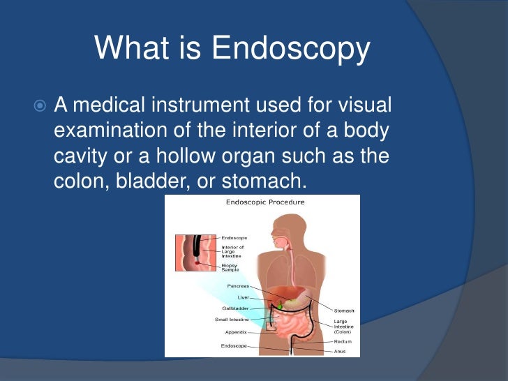 Endoscopy Biology Diagrams