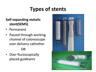 Types of stents
Self expanding metalic
  stent(SEMS)
• Permanent
• Passed through working
  channel of colonoscope
  over delivery cathether
          OR
• Over fluroscopically
  placed guidewire
 