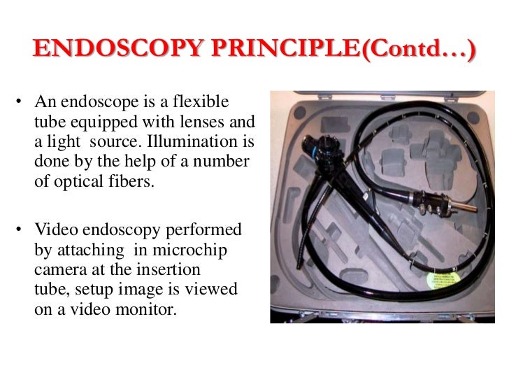 Endoscopy