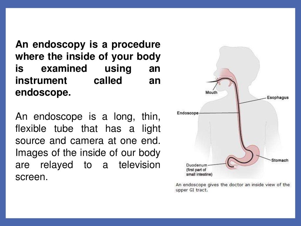Endoscopy