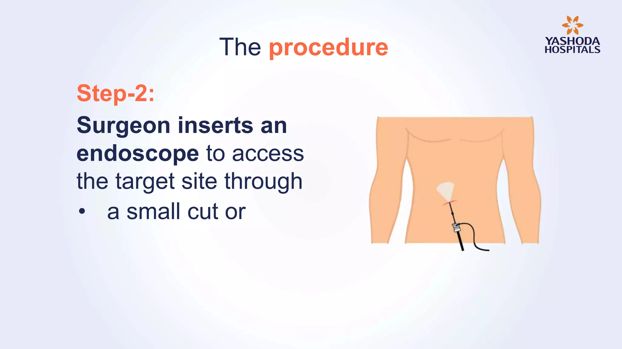 Endoscopy: Types, Preparation, Diagnosis, Procedure and Risks | PPTX