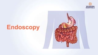 Endoscopy
 