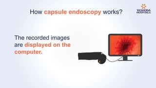 Endoscopy: Types, Preparation, Diagnosis, Procedure and Risks | PPTX