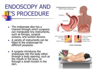 Endoscopy.pptx