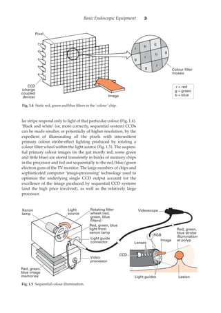lar stripe respond only to light of that particular colour (Fig.·1.4).
‘Black and white’ (or, more correctly, sequential system) CCDs
can be made smaller, or potentially of higher resolution, by the
expedient of illuminating all the pixels with intermittent
primary colour strobe-effect lighting produced by rotating a
colour ﬁlter wheel within the light source (Fig.·1.5). The sequen-
tial primary colour images (in the gut mostly red, some green
and little blue) are stored transiently in banks of memory chips
in the processor and fed out sequentially to the red/blue/green
electron guns of the TV monitor. The large numbers of chips and
sophisticated computer ‘image-processing’ technology used to
optimize the underlying single CCD output account for the
excellence of the image produced by sequential CCD systems
(and the high price involved), as well as the relatively large
processor.
Basic Endoscopic Equipment 3
Fig. 1.40Static red, green and blue ﬁlters in the ‘colour’ chip.
Colour filter
mosaic
r = red
g = green
b = blue
r
r
b
b
g
g
r
g
g
Pixel
CCD
(charge
coupled
device) Image
Xenon
lamp
Light
source
Light guide
connector
Video
processor
Red, green,
blue image
memories
CCD
Lenses
Light guides Lesion
Red, green,
blue strobe
illumination
at polyp
Rotating filter
wheel (red,
green, blue
filters)
Videoscope
Red, green, blue
light from
xenon lamp
Image
RGB
Fig. 1.50Sequential colour illumination.
 