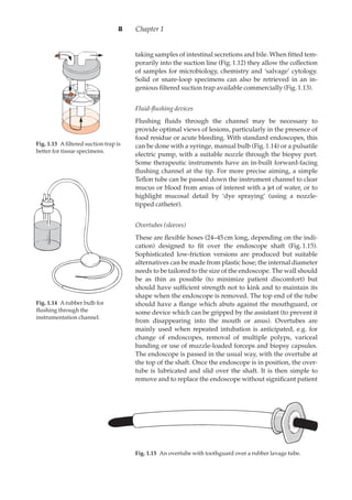 taking samples of intestinal secretions and bile. When ﬁtted tem-
porarily into the suction line (Fig.·1.12) they allow the collection
of samples for microbiology, chemistry and ‘salvage’ cytology.
Solid or snare-loop specimens can also be retrieved in an in-
genious ﬁltered suction trap available commercially (Fig.·1.13).
Fluid-ﬂushing devices
Flushing ﬂuids through the channel may be necessary to
provide optimal views of lesions, particularly in the presence of
food residue or acute bleeding. With standard endoscopes, this
can be done with a syringe, manual bulb (Fig.·1.14) or a pulsatile
electric pump, with a suitable nozzle through the biopsy port.
Some therapeutic instruments have an in-built forward-facing
ﬂushing channel at the tip. For more precise aiming, a simple
Teﬂon tube can be passed down the instrument channel to clear
mucus or blood from areas of interest with a jet of water, or to
highlight mucosal detail by ‘dye spraying’ (using a nozzle-
tipped catheter).
Overtubes (sleeves)
These are ﬂexible hoses (24–45·cm long, depending on the indi-
cation) designed to ﬁt over the endoscope shaft (Fig.·1.15).
Sophisticated low-friction versions are produced but suitable
alternatives can be made from plastic hose; the internal diameter
needs to be tailored to the size of the endoscope. The wall should
be as thin as possible (to minimize patient discomfort) but
should have sufﬁcient strength not to kink and to maintain its
shape when the endoscope is removed. The top end of the tube
should have a ﬂange which abuts against the mouthguard, or
some device which can be gripped by the assistant (to prevent it
from disappearing into the mouth or anus). Overtubes are
mainly used when repeated intubation is anticipated, e.g. for
change of endoscopes, removal of multiple polyps, variceal
banding or use of muzzle-loaded forceps and biopsy capsules.
The endoscope is passed in the usual way, with the overtube at
the top of the shaft. Once the endoscope is in position, the over-
tube is lubricated and slid over the shaft. It is then simple to
remove and to replace the endoscope without signiﬁcant patient
Chapter 18
Fig. 1.130Aﬁltered suction trap is
better for tissue specimens.
Fig. 1.140Arubber bulb for
ﬂushing through the
instrumentation channel.
Fig. 1.150An overtube with toothguard over a rubber lavage tube.
 