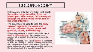 Endoscopy in surgery | PPTX