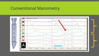 Endoscopy & Manometry for beginners .pptx