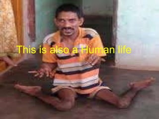This is also a Human life 