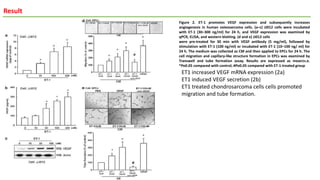 Result
Figure 2. ET-1 promotes VEGF expression and subsequently increases
angiogenesis in human osteosarcoma cells. (a–c) JJ012 cells were incubated
with ET-1 (30–300 ng/ml) for 24 h, and VEGF expression was examined by
qPCR, ELISA, and western blotting. (d and e) JJ012 cells
were pre-treated for 30 min with VEGF antibody (5 mg/ml), followed by
stimulation with ET-1 (100 ng/ml) or incubated with ET-1 (10–100 ng/ ml) for
24 h. The medium was collected as CM and then applied to EPCs for 24 h. The
cell migration and capillary-like structure formation in EPCs was examined by
Transwell and tube formation assay. Results are expressed as mean±s.e.
*Po0.05 compared with control; #Po0.05 compared with ET-1-treated group
ET1 increased VEGF mRNA expression (2a)
ET1 induced VEGF secretion (2b)
ET1 treated chondrosarcoma cells cells promoted
migration and tube formation.
 