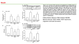 Result
Figure 3. ET-1 increases VEGF expression and angiogenesis via ERAR receptor. (a
and b) JJ012 cells were pre-treated with the BQ123 (5 mM) or BQ788 (10 mM)
for 30 min, followed by stimulation with ET-1 (100 nM) for 24 h, and VEGF
expression was examined by qPCR and ELISA. (c and d) JJ012 cells were pre-
treated with BQ123 (5 mM) or BQ788 (10 mM) for 30 min, followed by
stimulation with ET-1 (100 nM) for 24 h. The medium was collected as CM and
then applied to EPCs for 24 h. The cell migration and capillary-like structure
formation in EPCs was examined by Transwell and tube formation assay. Results
are expressed as mean±s.e. *Po0.05 compared with control; #Po0.05 compared
with ET-1- treated group.
ETAR inhibitor-BQ123; ETBR inhibitor-BQ788
BQ123 reduced VEGF mRNA, VEGF expression,
migration and tube formation.
 