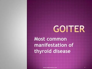 Most common
manifestation of
thyroid disease

www.medicinemcq.com

1

 