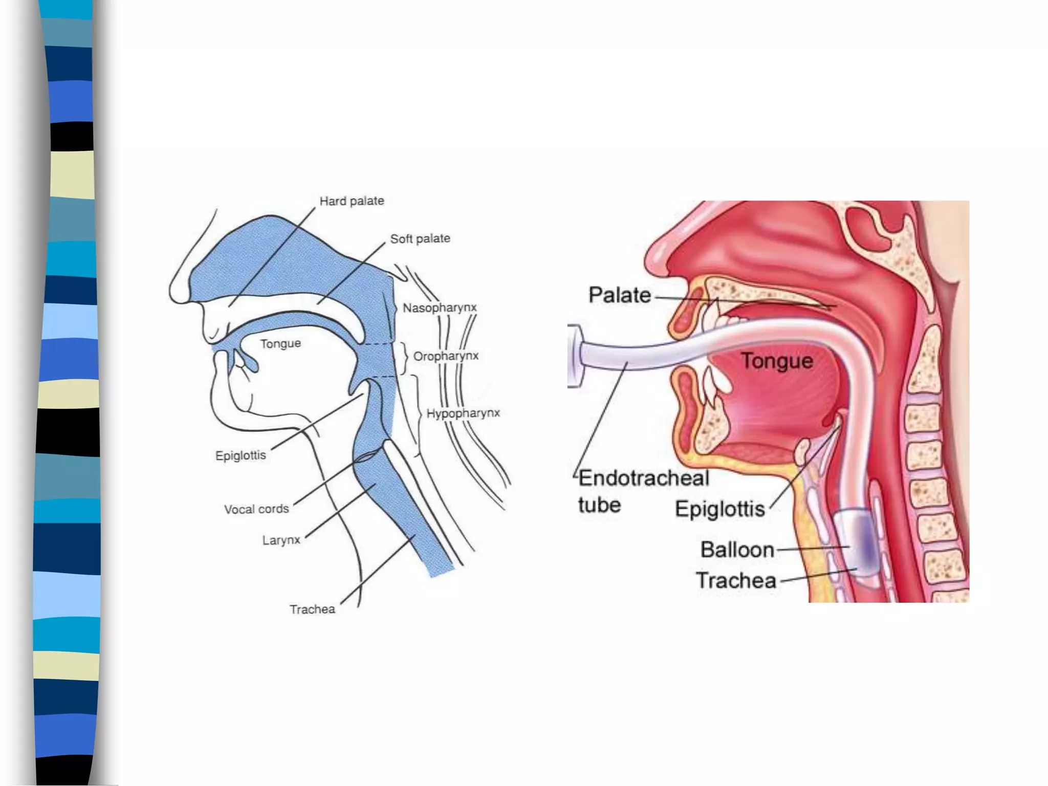 Endotracheal Intubation | PPTX
