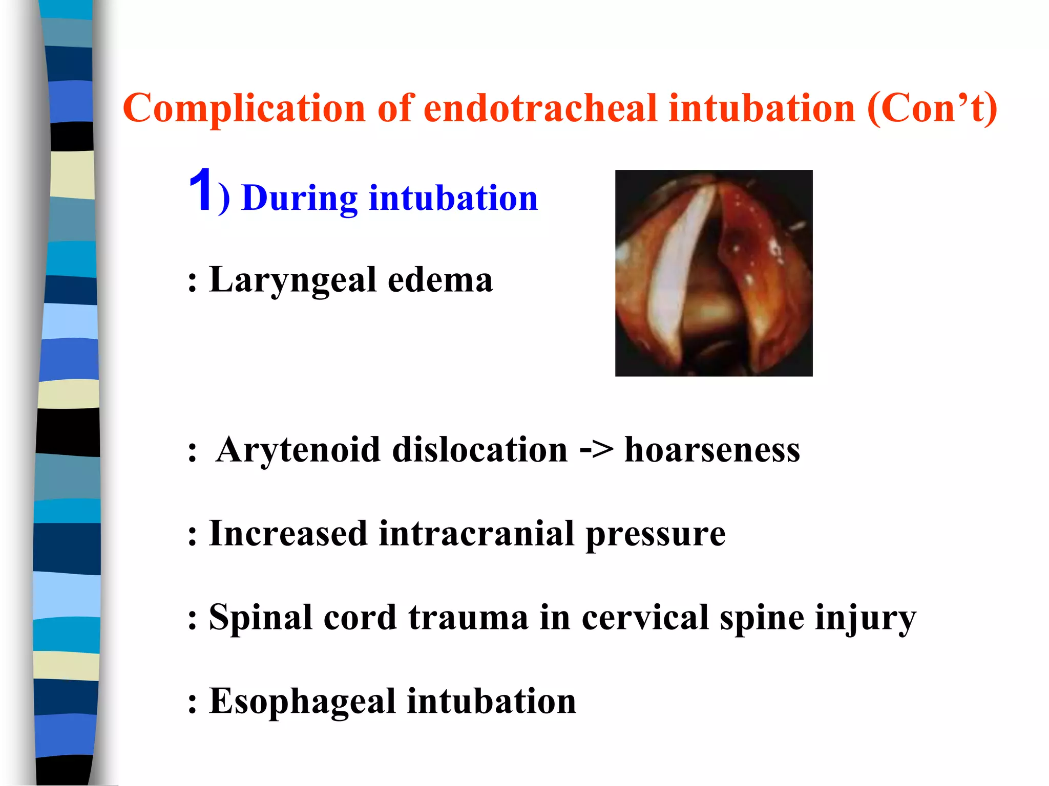 Endotracheal Intubation | PPTX