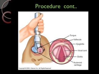 Procedure cont..Procedure cont..
 