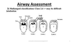 Airway Assessment
3) Mallampati classification: Class 3,4 -> may be difficult
intubation
Soft
palate
Uvula
endotracheal intubation/anesthesiology/184-244 11
 