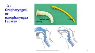 3.2
Oropharyngeal
or
nasopharyngea
l airway
Oral airway Nasal
airway
endotracheal intubation/anesthesiology/184-244 26
 