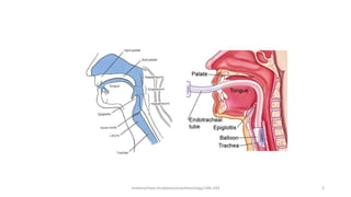 endotracheal intubation/anesthesiology/184-244 3
 