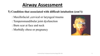 Airway Assessment
: Maxillofacial ,cervical or laryngeal trauma
: Temperomandibular joint dysfunction
: Burn scar at face and neck
: Morbidly obese or pregnancy
1) Condition that associated with difficult intubation (con’t)
endotracheal intubation/anesthesiology/184-244 9
 
