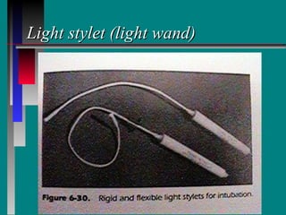 Light stylet (light wand) 