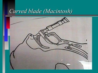 Curved blade (Macintosh) 