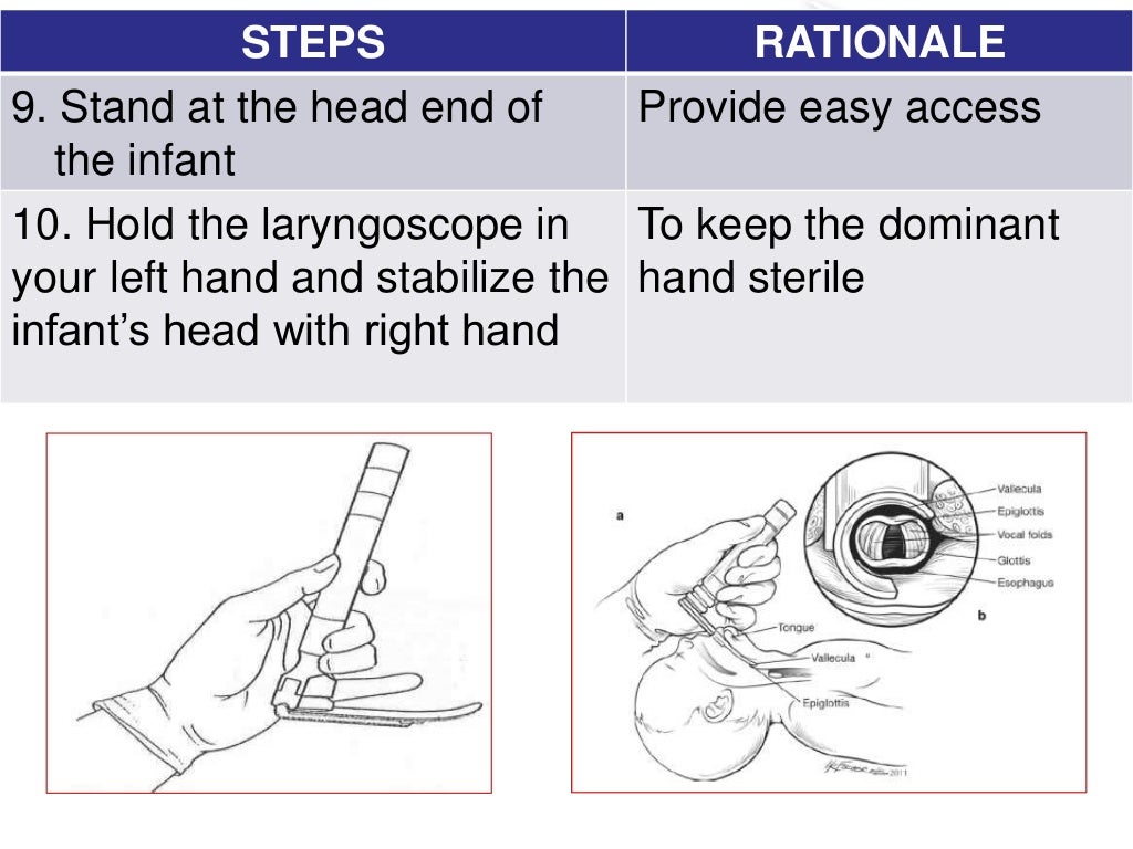 Endotracheal intubation nursing procedure