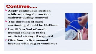 Endotracheal suctioning 2 | PPTX
