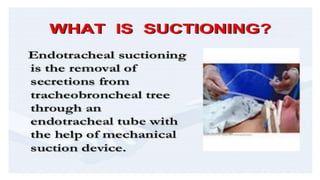 Endotracheal suctioning 2 | PPT