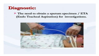 Endotracheal suctioning 2 | PPT