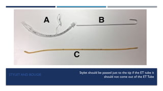 STYLET AND BOUGIE
Stylet should be passed just to the tip if the ET tube it
should not come out of the ET Tube
 