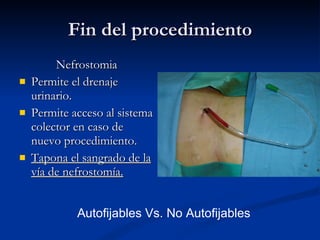 Fin del procedimiento Nefrostomia Permite el drenaje urinario. Permite acceso al sistema colector en caso de nuevo procedimiento. Tapona el sangrado de la vía de nefrostomía. Autofijables Vs. No Autofijables 